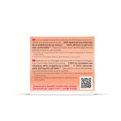 Weleda Mamma – burro smagliature –